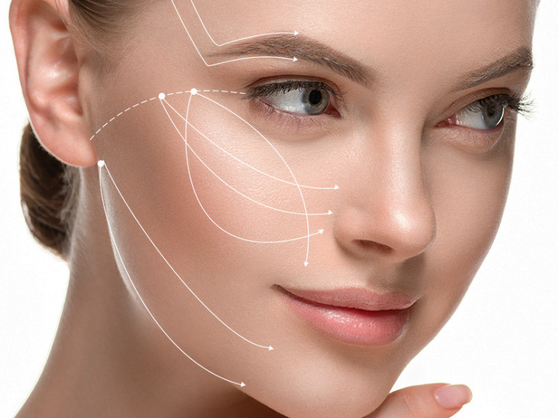Discover the Benefits of Aptos Thread Lifts for Surgery-Free Lifting with Dr. Caroline Carbasse