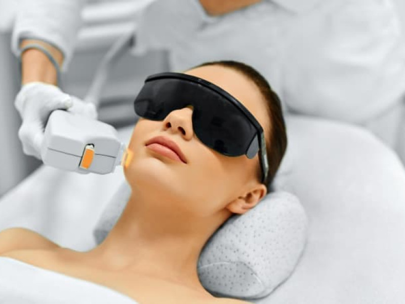 IPL Skin Laser Treatments in Javea: Personalized Expertise by Dr. Caroline Carbasse