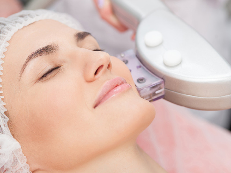 IPL Photorejuvenation: A Holistic Approach for Radiant Skin
