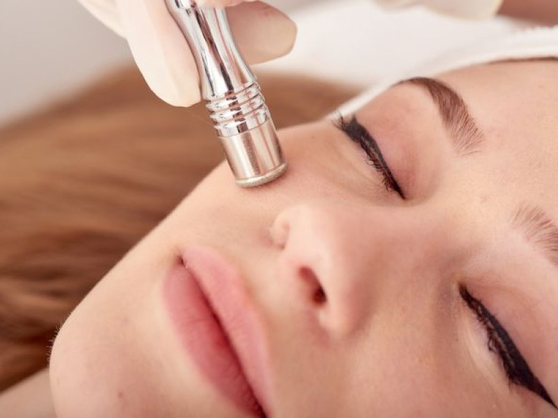 Discover the Benefits of Microdermabrasion at Estetica Javea
