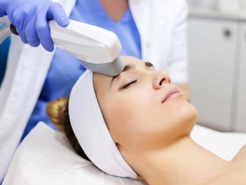 Skin Laser Treatments in Javea with Dr. Caroline Carbasse - Estetica Javea